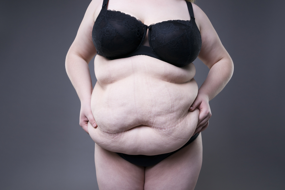 メタボ女性の腹囲は何㎝？体脂肪やBMIの目安は？
